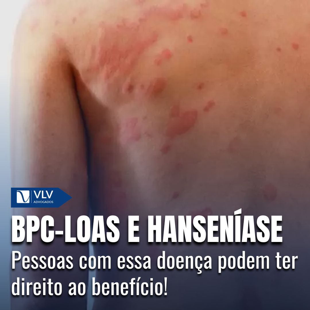 BPC-LOAS para quem tem hanseníase: Entenda os seus direitos!