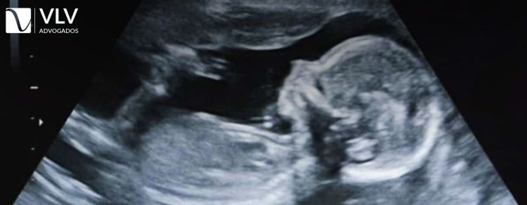 Erro na identificação de sexo do bebê
