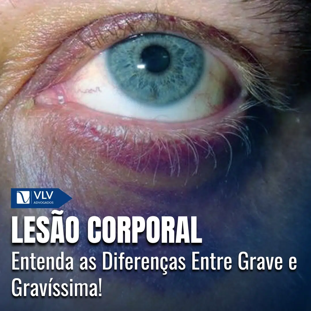 Lesão Corporal Grave e Gravíssima: O que você precisa saber?