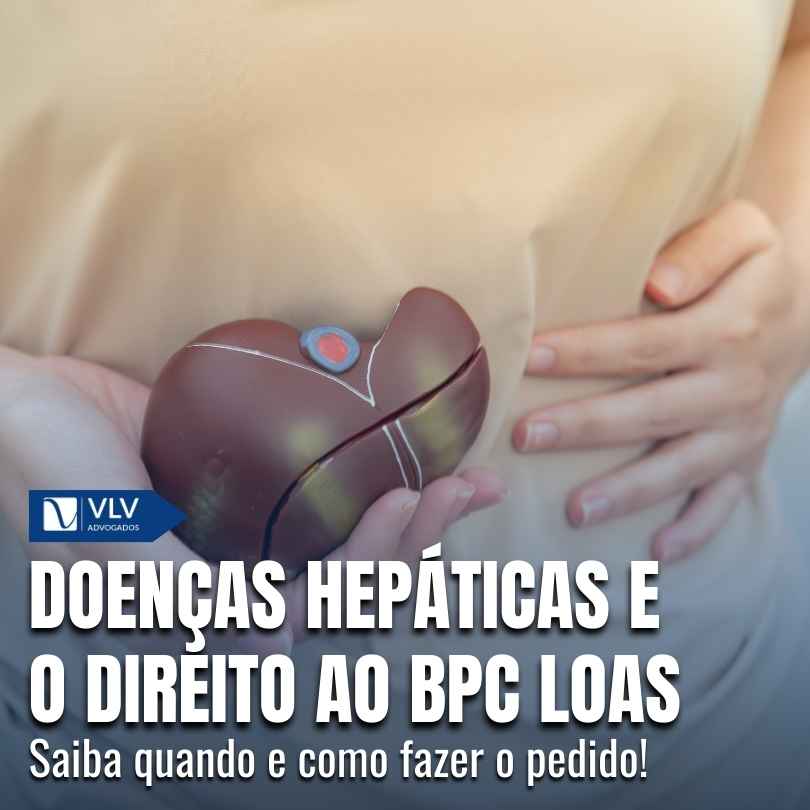 Blog Previdenciário 13 BPC LOAS para doencas hepaticas