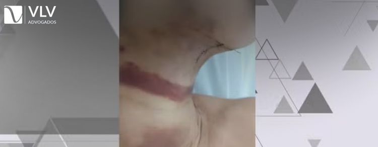 Clínica estética de luxo é fechada em Goiânia após erros 