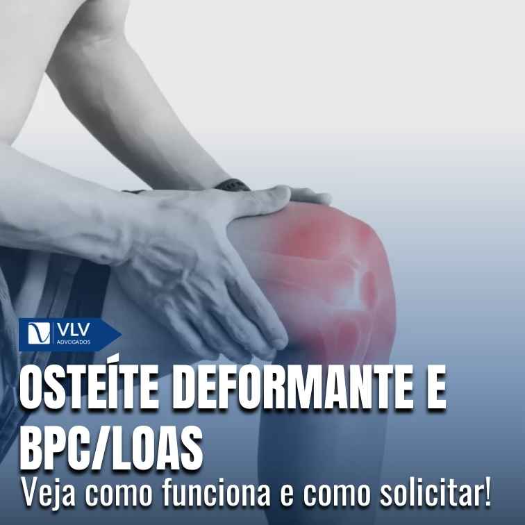 Blog 14 Osteíte deformante (doença de Paget) dá direito ao BPC?