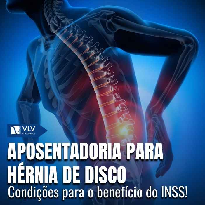 Quem tem hérnia de disco pode se aposentar? Guia 2025