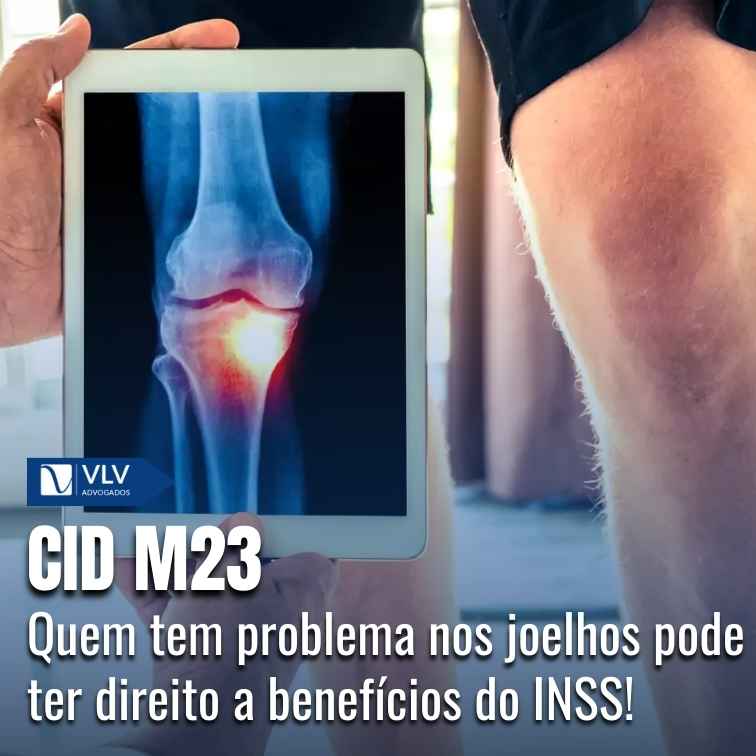 Blog 21 CID M23 – Transtornos internos dos joelhos aposenta?