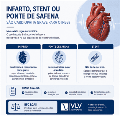 BPC LOAS em casos de cardiopatias graves! Como solicitar? 2 Infarto, stent ou ponte de safena são considerados cardiopatia grave para o INSS?
