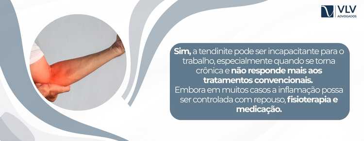 tendinite pode ser incapacitante para o trabalho