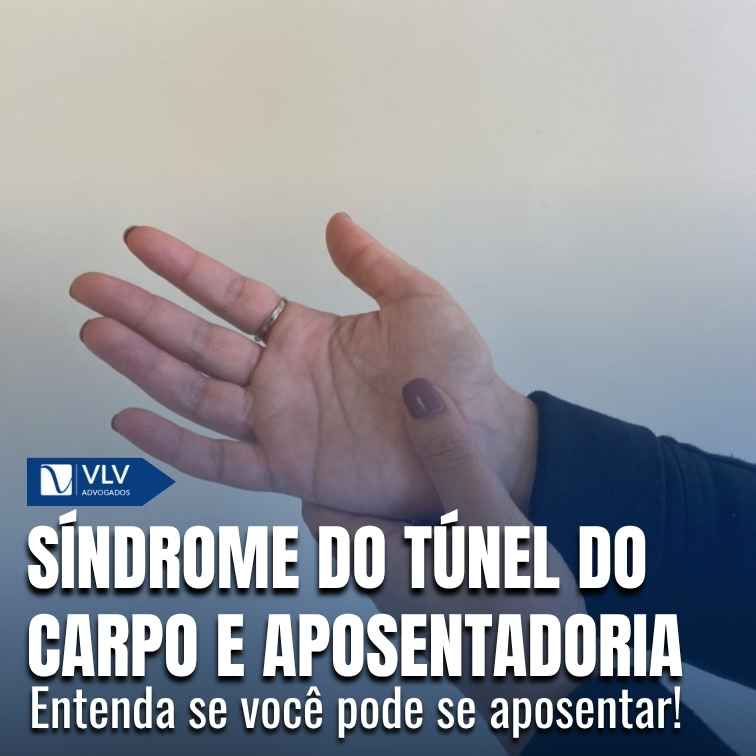 A síndrome do Túnel do Carpo dá direito à aposentadoria?