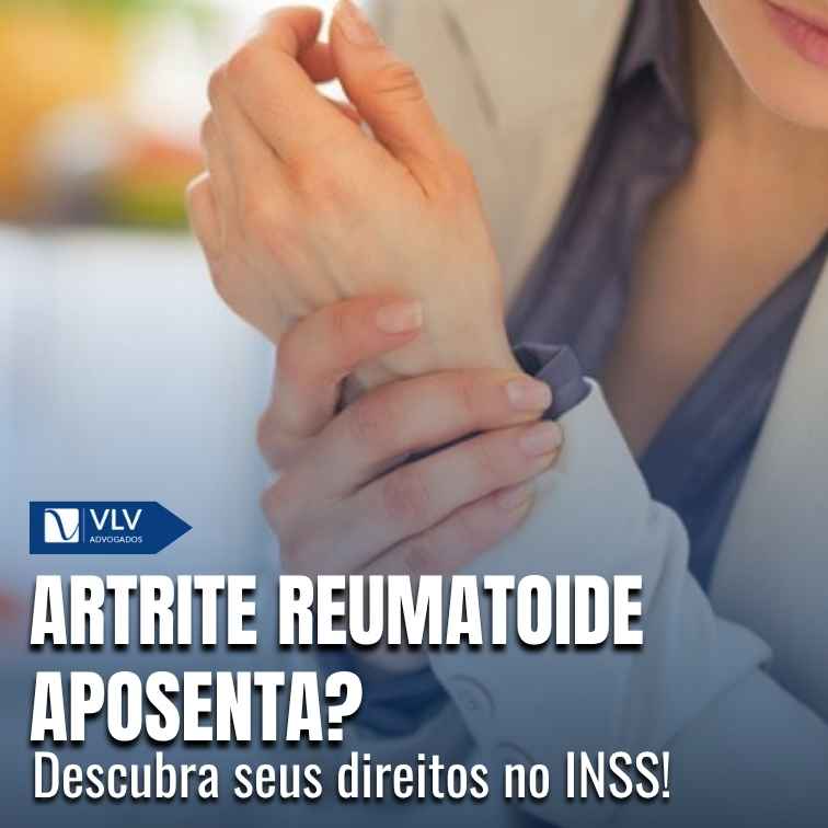 Artrite reumatoide (CID-10 M05) aposenta pelo INSS?