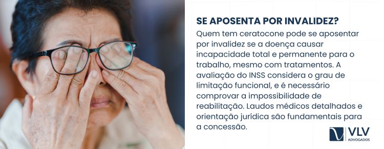 Ceratocone só gera aposentadoria por invalidez em casos graves com incapacidade total.