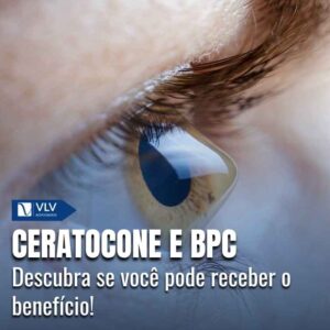 Ceratocone dá direito ao BPC LOAS pelo INSS