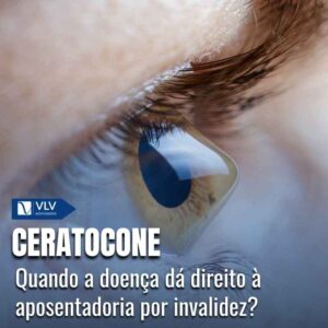 ceratocone pode se aposentar por invalidez