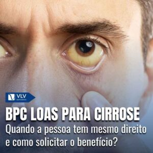 Cirrose dá direito ao BPC LOAS? Descubra! 5 BPC LOAS para cirrose 1