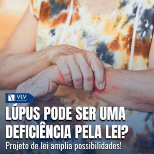 Lupus pode ser equiparado a uma deficiencia