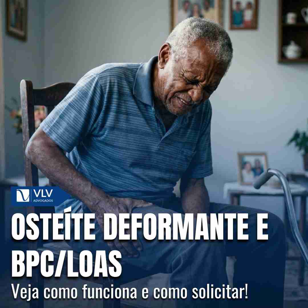 Blog Previdenciário 16 osteite deformante e bpc loas