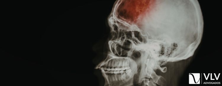 imagem representando traumatismo craniano